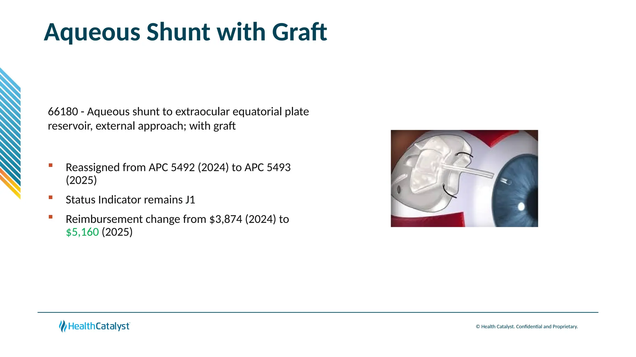 © Health Catalyst. Confidential and Proprietary.
Aqueous Shunt with Graft
66180 - Aqueous shunt to extraocular equatorial plate
reservoir, external approach; with graft
 Reassigned from APC 5492 (2024) to APC 5493
(2025)
 Status Indicator remains J1
 Reimbursement change from $3,874 (2024) to
$5,160 (2025)
 