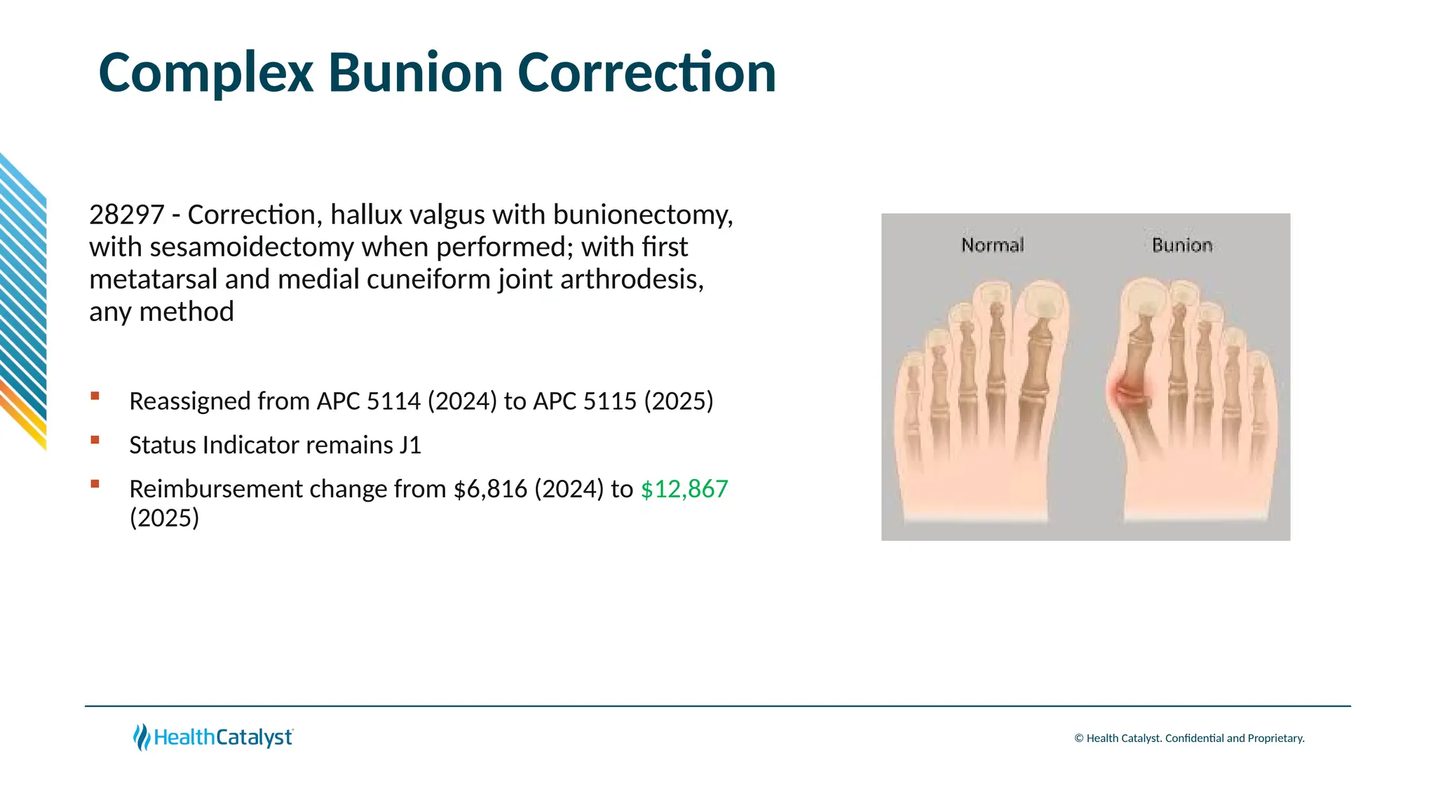 © Health Catalyst. Confidential and Proprietary.
Complex Bunion Correction
28297 - Correction, hallux valgus with bunionectomy,
with sesamoidectomy when performed; with first
metatarsal and medial cuneiform joint arthrodesis,
any method
 Reassigned from APC 5114 (2024) to APC 5115 (2025)
 Status Indicator remains J1
 Reimbursement change from $6,816 (2024) to $12,867
(2025)
 