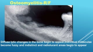 Osteomyelitis-R/F
Diffuse lytic changes in the bone begin to appear,Individual trabeculae
become fuzzy and indistinct and radiolucent areas begin to appear
 