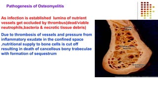 Pathogenesis of Osteomyelitis
As infection is established lumina of nutrient
vessels get occluded by thrombus(dead/viable
neutrophils,bacteria & necrotic tissue debris)
Due to thrombosis of vessels and pressure from
inflammatory exudate in the confined space
,nutritional supply to bone cells is cut off
resulting in death of cancellous bony trabeculae
with formation of sequestrum
 