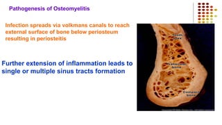 Pathogenesis of Osteomyelitis
Infection spreads via volkmans canals to reach
external surface of bone below periosteum
resulting in periosteitis
Further extension of inflammation leads to
single or multiple sinus tracts formation
 