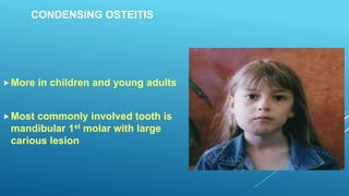 CONDENSING OSTEITIS
More in children and young adults
Most commonly involved tooth is
mandibular 1st molar with large
carious lesion
 