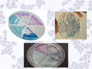 Comprehensive Overview of Opportunistic Mycoses and Candidiasis ...