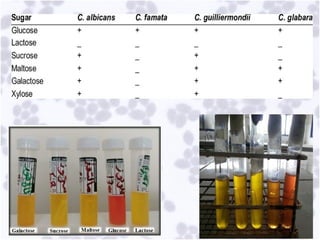 Comprehensive Overview of Opportunistic Mycoses and Candidiasis ...