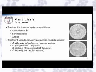 Comprehensive Overview of Opportunistic Mycoses and Candidiasis ...