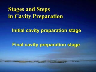 Stages and Steps 
in Cavity Preparation 
Initial cavity preparation stage 
Final cavity preparation stage 
 