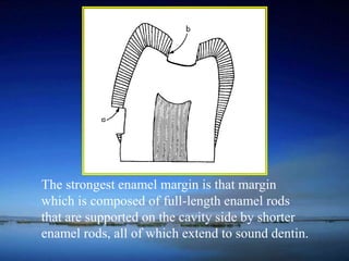 The strongest enamel margin is that margin 
which is composed of full-length enamel rods 
that are supported on the cavity side by shorter 
enamel rods, all of which extend to sound dentin. 
 