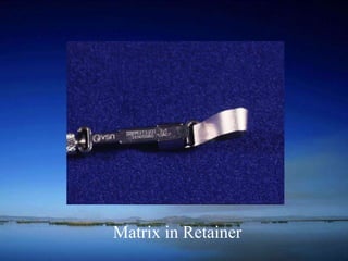 Matrix in Retainer 
 