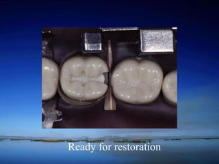 Ready for restoration 
 