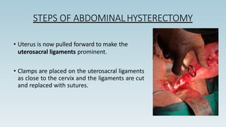 • Uterus is now pulled forward to make the
uterosacral ligaments prominent.
• Clamps are placed on the uterosacral ligaments
as close to the cervix and the ligaments are cut
and replaced with sutures.
STEPS OF ABDOMINAL HYSTERECTOMY
 