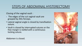 STEPS OF ABDOMINAL HYSTERECTOMY
Closing of the vaginal vault :
• The edges of the cut vaginal vault are
grasped by Allis forceps.
• Lateral vaginal angle is closed by transfixation
suture.
• Vault is closed by interrupted sutures or the
free margin is reefed with a continuous
locking suture.
Abdomen is closed.
 