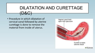 DILATATION AND CURETTAGE
(D&C)
• Procedure in which dilatation of
cervical canal followed by uterine
curettage is done to remove the
material from inside of uterus.
 