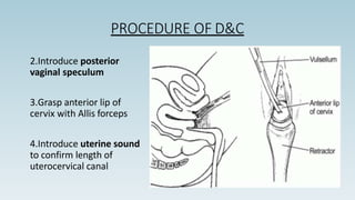 PROCEDURE OF D&C
2.Introduce posterior
vaginal speculum
3.Grasp anterior lip of
cervix with Allis forceps
4.Introduce uterine sound
to confirm length of
uterocervical canal
 