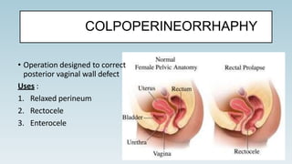 COLPOPERINEORRHAPHY
• Operation designed to correct
posterior vaginal wall defect
Uses :
1. Relaxed perineum
2. Rectocele
3. Enterocele
 
