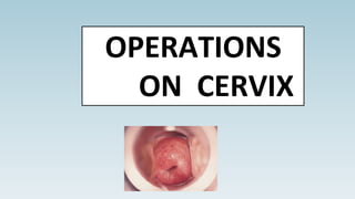 OPERATIONS
ON CERVIX
 