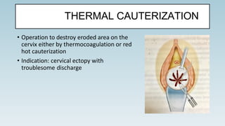 • Operation to destroy eroded area on the
cervix either by thermocoagulation or red
hot cauterization
• Indication: cervical ectopy with
troublesome discharge
THERMAL CAUTERIZATION
 