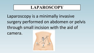 LAPAROSCOPY
Laparoscopy is a minimally invasive
surgery performed on abdomen or pelvis
through small incision with the aid of
camera.
 