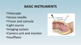 •Telescope
•Veress needle
•Trocar and cannula
•Light source
•Imaging system
•Camera unit and monitor
•Insufflator
BASIC INSTRUMENTS
 