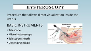 HYSTEROSCOPY
Procedure that allows direct visualization inside the
uterus
BASIC INSTRUMENTS
• Telescope
• Microhysteroscope
• Telescope sheath
• Distending media
 