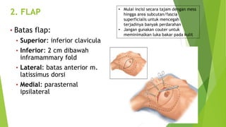 Optek MRM - CAX.pptx