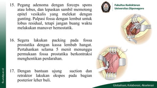 Packing Prostatic Fossa Comprehensive Guide to Open Prostatectomy and LUTS Management | PPTX