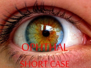 OPHTHAL
SHORT CASE11/18/2013 1ophthal short case
 
