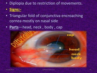 • Diplopia due to restriction of movements.
• Signs:-
• Triangular fold of conjunctiva encroaching
cornea mostly on nasal side
• Parts—head, neck , body , cap
11/18/2013 ophthal short case 17
 