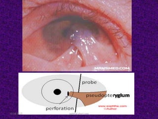 11/18/2013 7ophthal short case
 