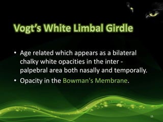 • Age related which appears as a bilateral
chalky white opacities in the inter -
palpebral area both nasally and temporally.
• Opacity in the Bowman's Membrane.
15
 