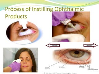 Process of Instilling Ophthalmic
Products
14RIPS
 