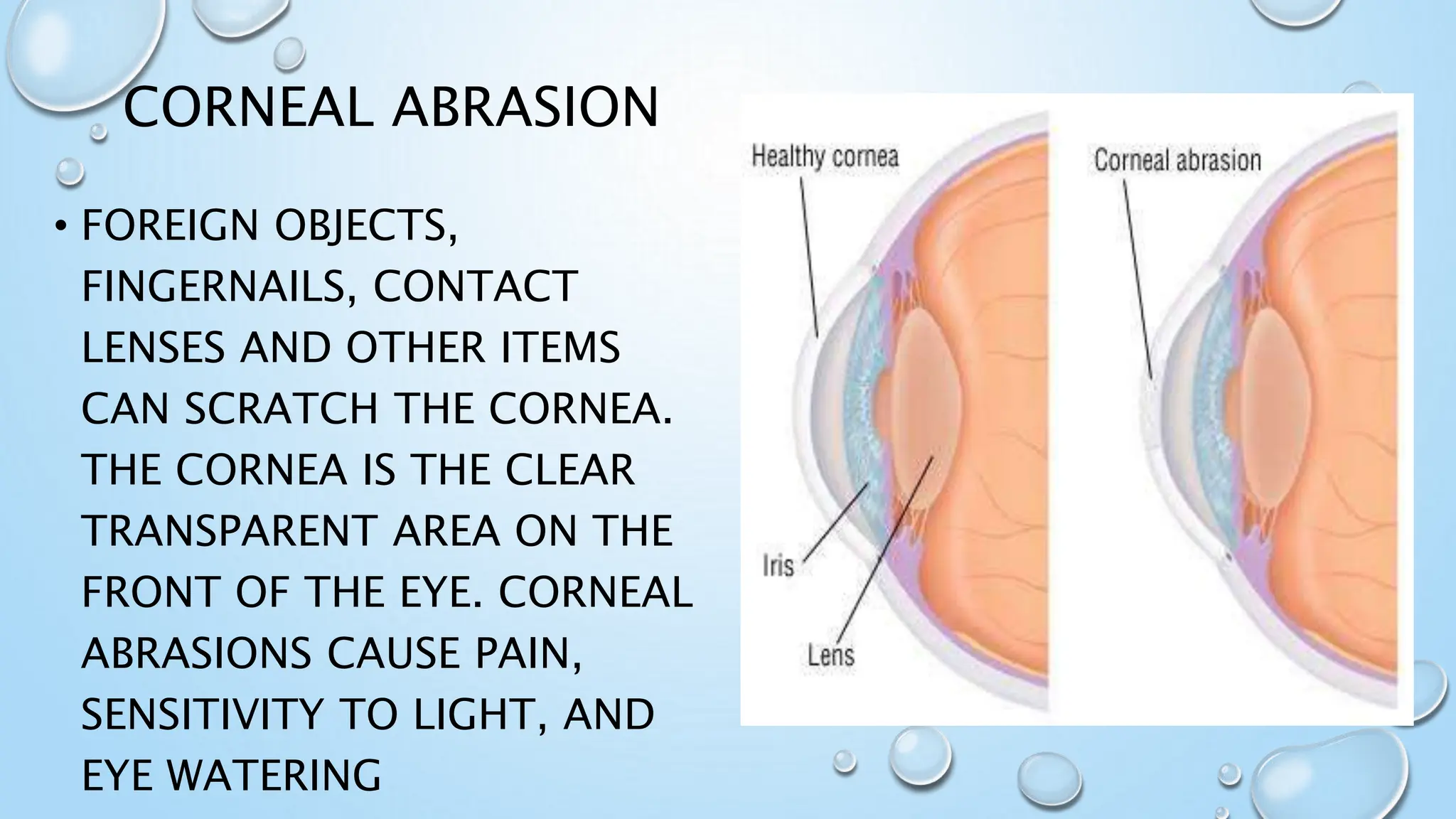 opthalmology - Injuries of organ of vision, eye..pptx