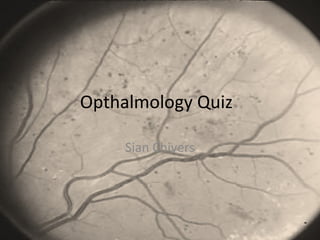 Opthalmology Quiz
Sian Chivers
 