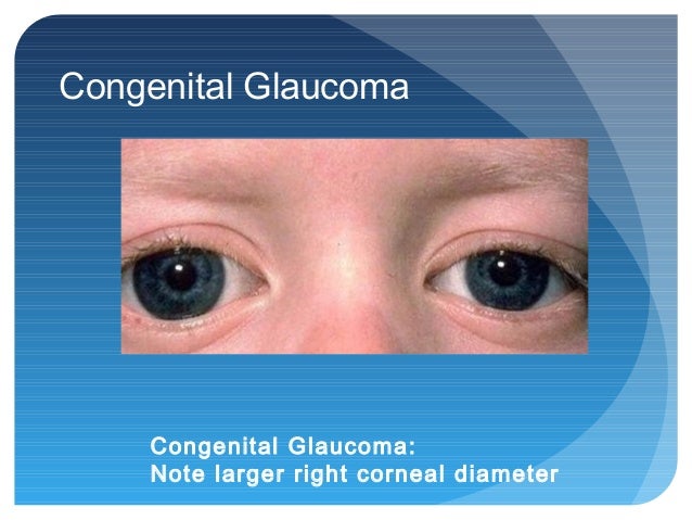 e eye test tumbling for Opthalmology pediatricians e eye test tumbling for Opthalmology pediatricians