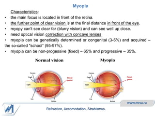 Myopy opthalmology different types of diseases complete.pdf
