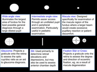 Wide angle view: 
Illuminates the largest 
area of fundus for the 
best possible general 
diagnosis through a 
large dilated pupil 
Intermediate angle view: 
Permits easier access 
through an undilated pupil 
and in peripheral 
examination. Particularly 
useful in pediatric 
examination. 
Macula view: Designed 
specifically for examination of 
the macula region of the 
fundus where a larger beam 
would create excessive 
pupillary reaction or patient 
discomfort. 
Glaucoma: Projects a 
graticule onto the retina 
to assess the optic 
cup/disc ratio as an aid 
to glaucoma diagnosis. 
Slit: Used primarily to 
determine retinal 
elevations and 
depressions, but may 
also be used to assess 
anterior chamber depth 
Fixation Star or Cross: 
Projects a graticule onto the 
retina to assess the degree 
and direction of eccentric 
fixation, eg, as a result of 
macula degeneration 
 