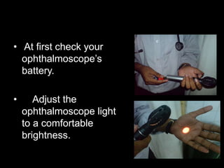 • At first check your 
ophthalmoscope’s 
battery. 
• Adjust the 
ophthalmoscope light 
to a comfortable 
brightness. 
 