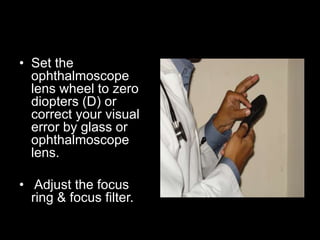 • Set the 
ophthalmoscope 
lens wheel to zero 
diopters (D) or 
correct your visual 
error by glass or 
ophthalmoscope 
lens. 
• Adjust the focus 
ring & focus filter. 
 