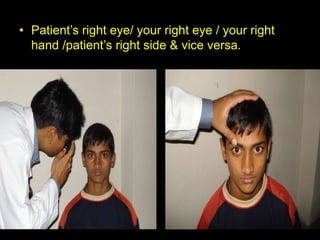 • Patient’s right eye/ your right eye / your right 
hand /patient’s right side & vice versa. 
 