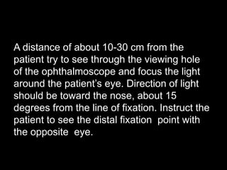 A distance of about 10-30 cm from the 
patient try to see through the viewing hole 
of the ophthalmoscope and focus the light 
around the patient’s eye. Direction of light 
should be toward the nose, about 15 
degrees from the line of fixation. Instruct the 
patient to see the distal fixation point with 
the opposite eye. 
 