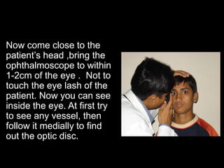 Now come close to the 
patient’s head ,bring the 
ophthalmoscope to within 
1-2cm of the eye . Not to 
touch the eye lash of the 
patient. Now you can see 
inside the eye. At first try 
to see any vessel, then 
follow it medially to find 
out the optic disc. 
 