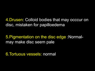 4.Drusen: Colloid bodies that may occcur on 
disc, mistaken for papilloedema 
5.Pigmentation on the disc edge :Normal-may 
make disc seem pale 
6.Tortuous vessels: normal 
 