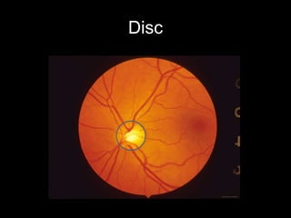 Disc 
 