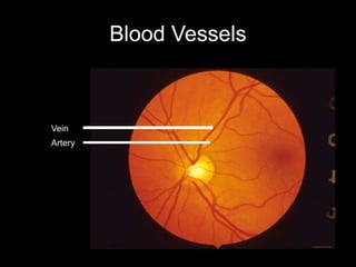 Blood Vessels 
Vein 
Artery 
 