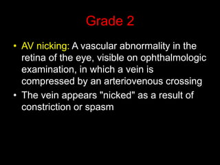 Grade 2 
• AV nicking: A vascular abnormality in the 
retina of the eye, visible on ophthalmologic 
examination, in which a vein is 
compressed by an arteriovenous crossing 
• The vein appears "nicked" as a result of 
constriction or spasm 
 