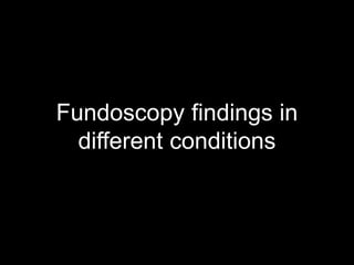 Fundoscopy findings in 
different conditions 
 