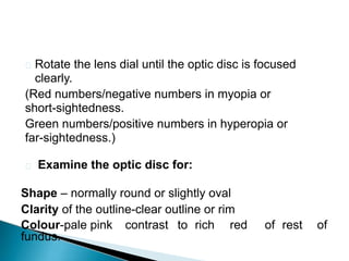  Rotate the lens dial until the optic disc is focused
clearly.
(Red numbers/negative numbers in myopia or
short-sightedness.
Green numbers/positive numbers in hyperopia or
far-sightedness.)
 Examine the optic disc for:
Shape – normally round or slightly oval
Clarity of the outline-clear outline or rim
Colour-pale pink contrast to rich red of rest of
fundus.
 