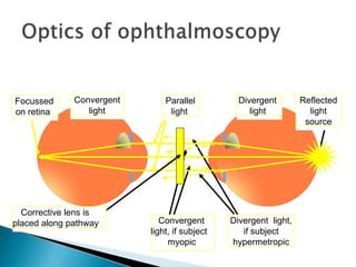 Divergent light,
if subject
hypermetropic
Reflected
light
source
Convergent
light, if subject
myopic
Divergent
light
Convergent
light
Parallel
light
Focussed
on retina
Corrective lens is
placed along pathway
 