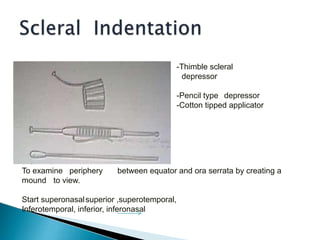 -Thimble scleral
depressor
-Pencil type depressor
-Cotton tipped applicator
To examine periphery between equator and ora serrata by creating a
mound to view.
Start superonasalsuperior ,superotemporal,
Inferotemporal, inferior, inferonasal
 