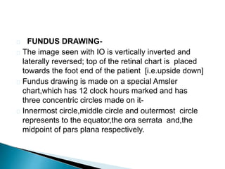  FUNDUS DRAWING-
 The image seen with IO is vertically inverted and
laterally reversed; top of the retinal chart is placed
towards the foot end of the patient [i.e.upside down]
 Fundus drawing is made on a special Amsler
chart,which has 12 clock hours marked and has
three concentric circles made on it-
 Innermost circle,middle circle and outermost circle
represents to the equator,the ora serrata and,the
midpoint of pars plana respectively.
 