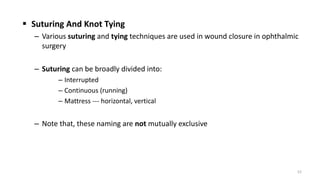 Suturing And Knot Tying
– Various suturing and tying techniques are used in wound closure in ophthalmic
surgery
– Suturing can be broadly divided into:
– Interrupted
– Continuous (running)
– Mattress --- horizontal, vertical
– Note that, these naming are not mutually exclusive
52
 